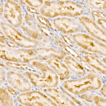 GPS1 antibody