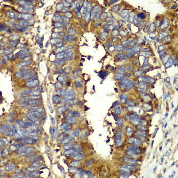 QARS antibody