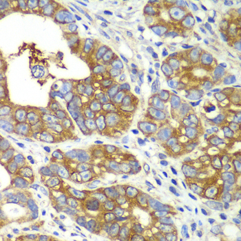 QARS antibody