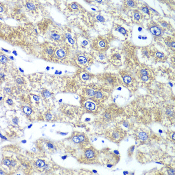 QARS antibody