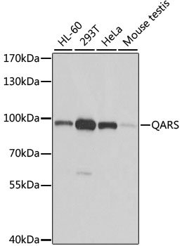 QARS antibody