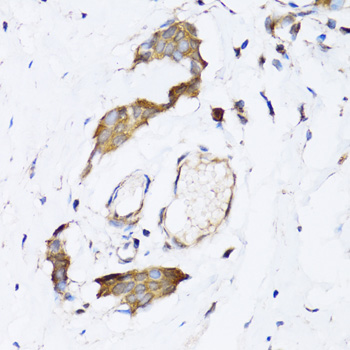 NAA10 antibody