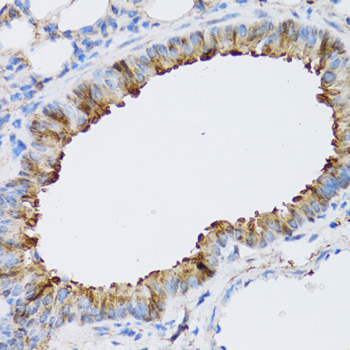 NAA10 antibody