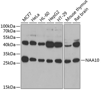 NAA10 antibody