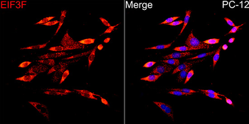 EIF3F antibody