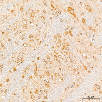 EIF3F antibody