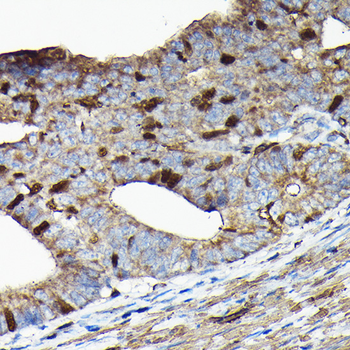 PRC1 antibody