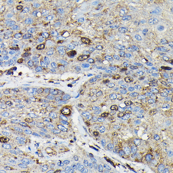 PRC1 antibody