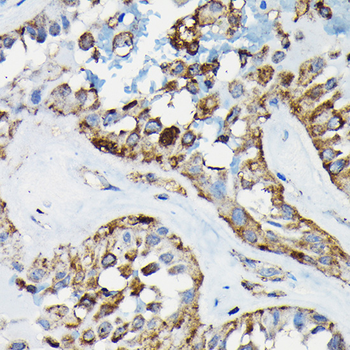 PRC1 antibody