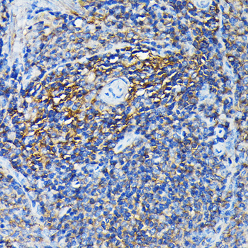 PRC1 antibody