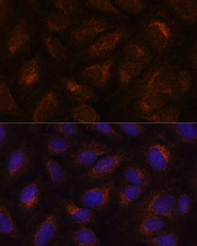 AGR2 antibody