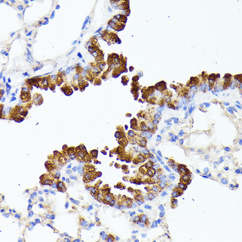 SMYD4 antibody