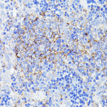 SMYD4 antibody