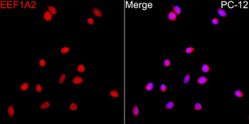 EEF1A2 antibody