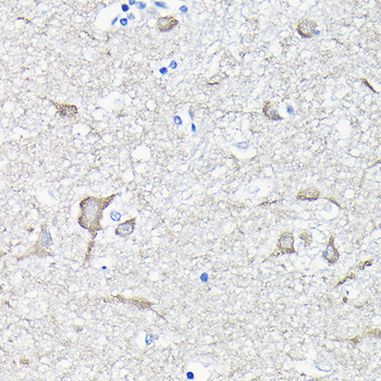 EEF1A2 antibody