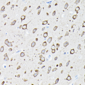 EEF1A2 antibody