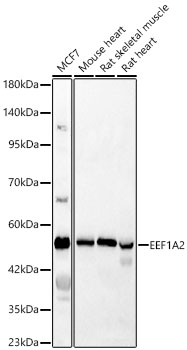 EEF1A2 antibody