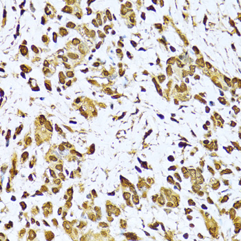 XRCC6 antibody