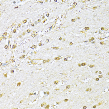 XRCC6 antibody