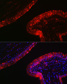 KRT16 antibody