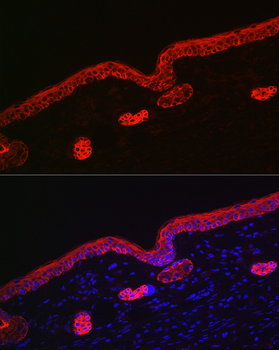 KRT16 antibody