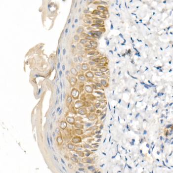 KRT16 antibody