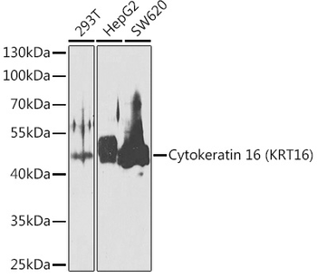 KRT16 antibody