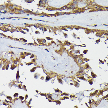 TARBP2 antibody