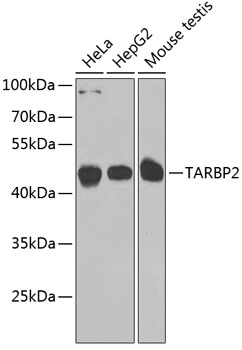 TARBP2 antibody