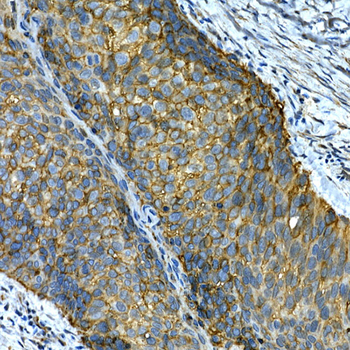 ITGA2 antibody