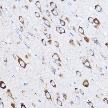 RPL8 antibody