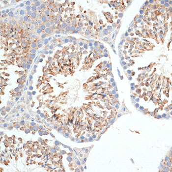 KLHL9 antibody