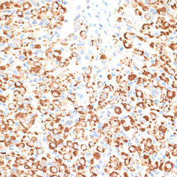 KLHL9 antibody