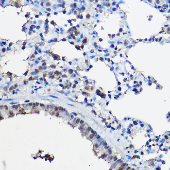 NCOA2 antibody