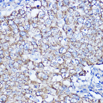 LRPPRC antibody