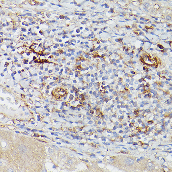 ENTPD1 antibody