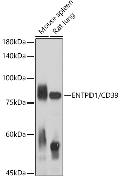 ENTPD1 antibody