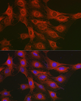 GART antibody