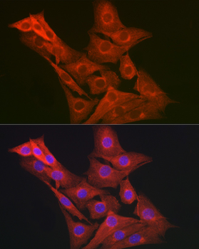 GART antibody