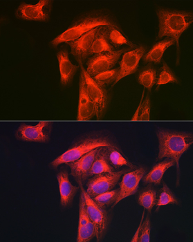 GART antibody