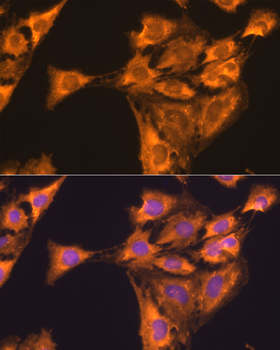 RPL23 antibody