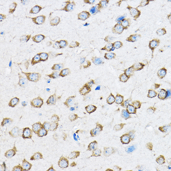 RPL23 antibody