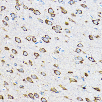 RPL23 antibody