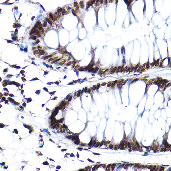 SF3A3 antibody