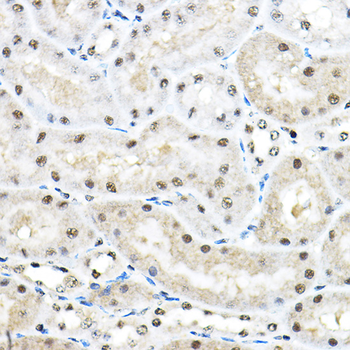 SF3A3 antibody