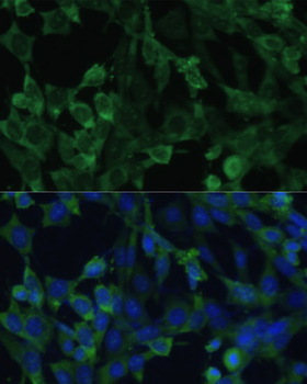 EIF1AX antibody