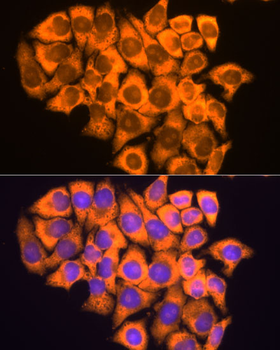 RPL17 antibody