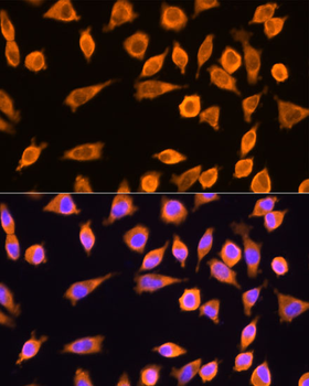 RPL17 antibody