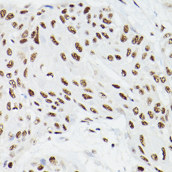 CPSF6 antibody