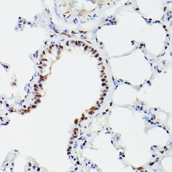 CPSF6 antibody